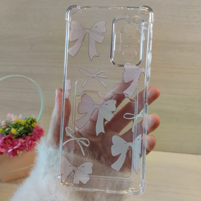 Чехол на xiaomi redmi Note 10 pro силиконовый прозрачный с отделом под карточки (бантики) - Зображення 7